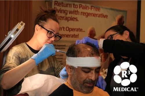 Aesthetics Training Course for Hair Restoration